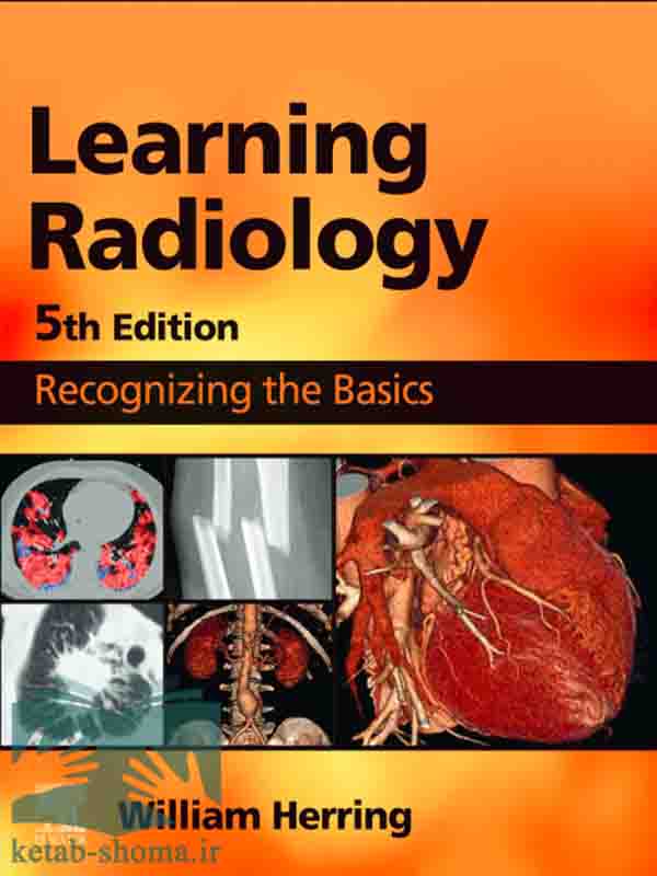 Learning Radillogy کتاب رادیولوژی هرینگ(ویراست5)(Learning Radiology: Recognizing the ...